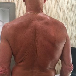 New Form Physical Therapy and Wellness Center - My upper back and shoulders AFTER working with Dr. Salles