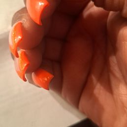 Bumpy  uneven nails