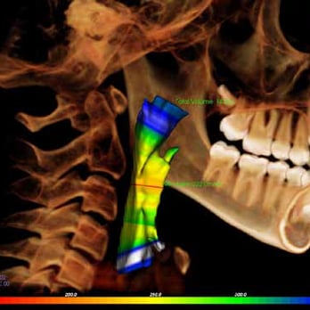 Dr. Smith's Orthodontic Services - Superior images with far less radiation than traditional x-rays. - Orthodontists Near Me - Plantation, Florida Dr. Smith's Orthodontic Services - Superior images with far less radiation than traditional x-rays. - Orthodontists Near Me - Plantation, Florida