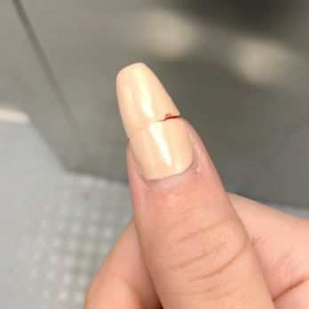 Kim's Nail & Spa - poorly done acrylics broke so short i bled. - Nail Salons Near Me - Flushing, New York