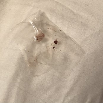 Eli's Cheesecake - BAD- UNSAFE MFG. PLASTIC in them. - Desserts Near Me - Chicago, Illinois Eli's Cheesecake - BAD- UNSAFE MFG. PLASTIC in them. - Desserts Near Me - Chicago, Illinois