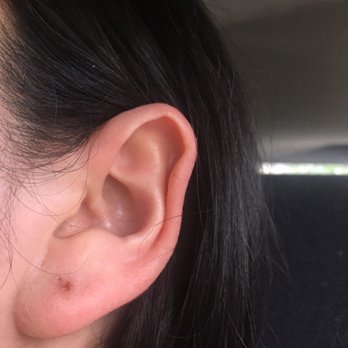 BURDLIFE - Infected earlobe - Accessories Near Me - Houston, Texas