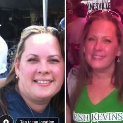 Nuviva Medical Weight Loss Clinic Of Lake Mary - Before and after