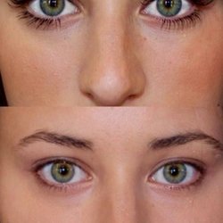 Simply Skin