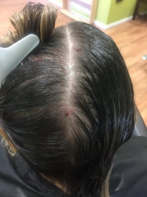 Nit Picky Lice Salon Services 43053 Margarita Rd Temecula Ca