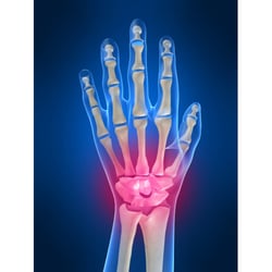 Colorado Hand & Arm, PC