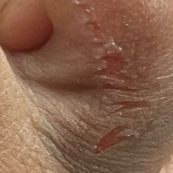 Fancy Nails - Cut toe