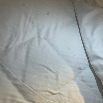 DoubleTree by Hilton Hotel Fort Lee - George Washington Bridge - Dirty bedding - Hotels Near Me - Fort Lee, New Jersey