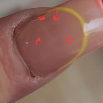 Lecheta Nail Bar - bumps in my nails. - Nail Salons Near Me - Bellflower, California Lecheta Nail Bar - bumps in my nails. - Nail Salons Near Me - Bellflower, California