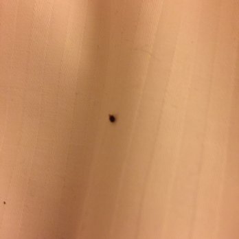 Hilton Baltimore Inner Harbor - Bedbugs. Never again - Hotels Near Me - Baltimore, Maryland Hilton Baltimore Inner Harbor - Bedbugs. Never again - Hotels Near Me - Baltimore, Maryland