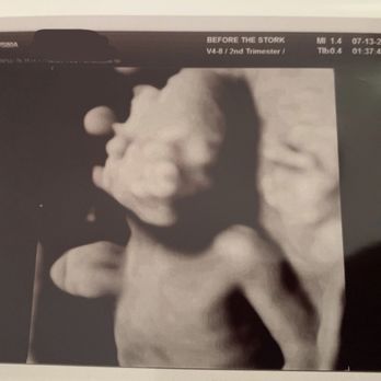 Before the Stork 4D - 16 week 3D glimpse. - Ultrasound Imaging Centers Near Me - Anaheim, California