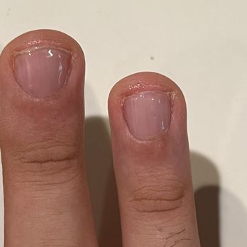 Modern Nails - A close-up image of two fingers with visible fingernails and skin texture, set against a plain background. - Nail Salons Near Me - Indianapolis, Indiana