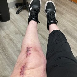 Commons Clinic - Healing slowly but feeling good