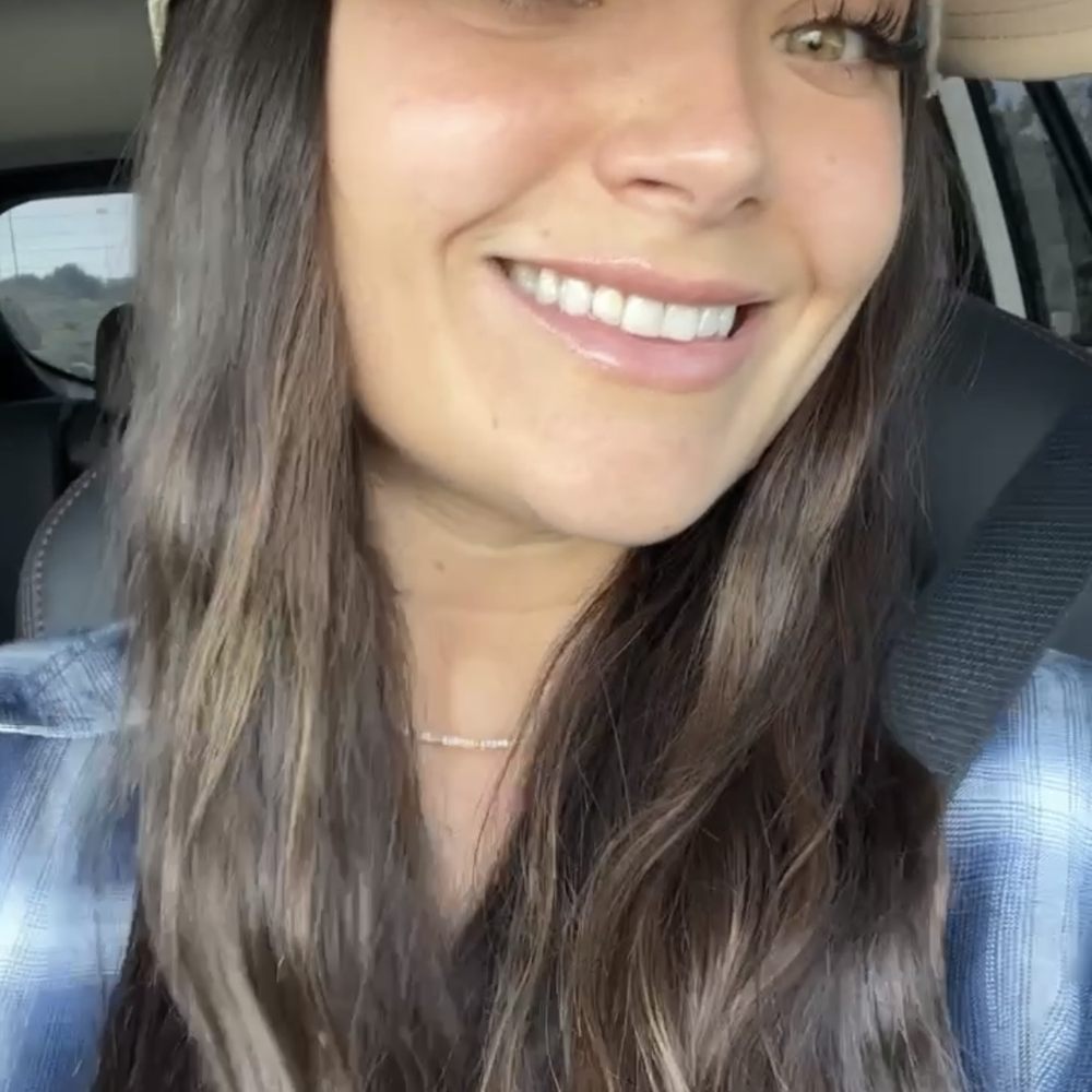 BioSpa - 4th day post op, and perfect! - Medical Spas Near Me - Newport Beach, California BioSpa - 4th day post op, and perfect! - Medical Spas Near Me - Newport Beach, California