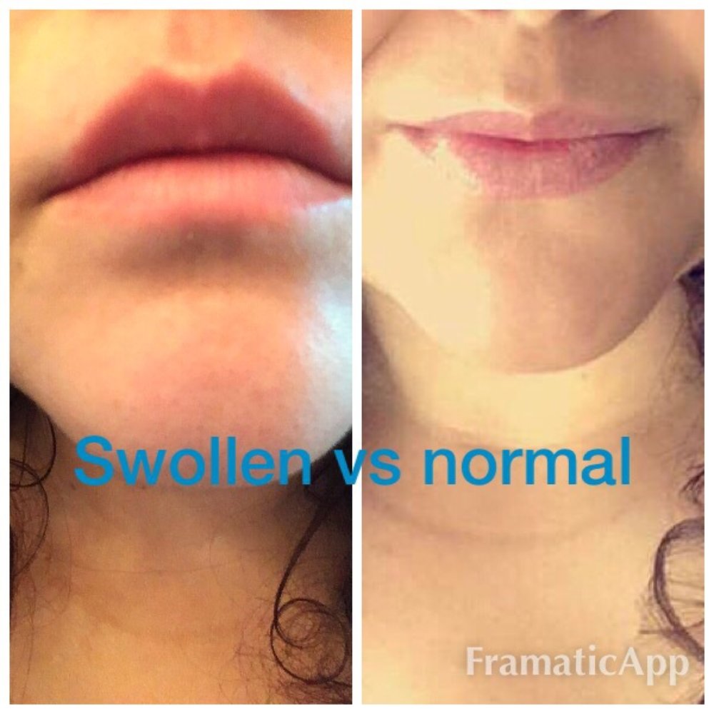 Brow Shapes Threading - Yep. I wish my lip was normally that big... My upper lip burned the whole way home. - Threading Services Near Me - San Dimas, California