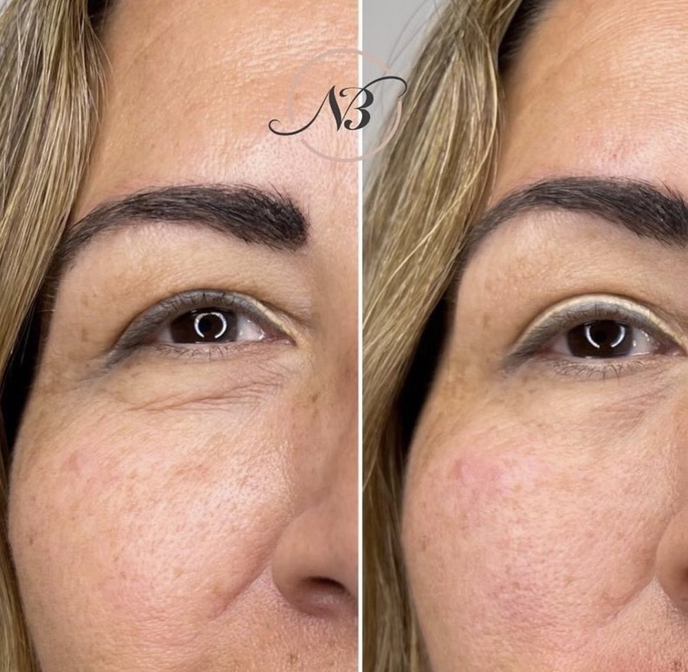 NUBELLA MED SPA Updated September 2024 21 Photos & 28 Reviews