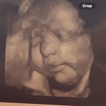 Unique Ultrasound - 34 weeks pregnant . - Ultrasound Imaging Centers Near Me - Poway, California