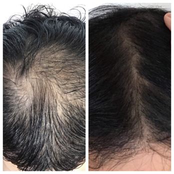 A Greater Whole - Skin Care Near Me - Kirkland, Washington A Greater Whole - Skin Care Near Me - Kirkland, Washington