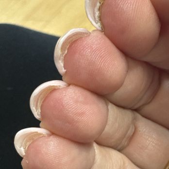 True Touch Nail 4 - The old set of nails under the new set after i asked to have them taken off. - Nail Salons Near Me - Peoria, Arizona