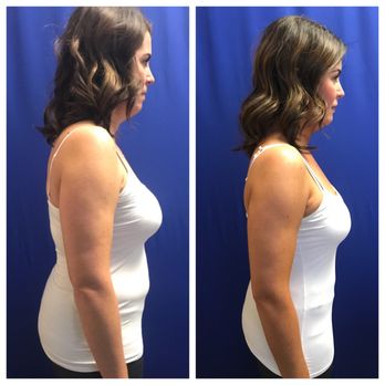 Beyond Beauty Aesthetics - Medical Spas Near Me - Sacramento, California Beyond Beauty Aesthetics - Medical Spas Near Me - Sacramento, California