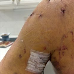 Pinnacle Orthopaedics