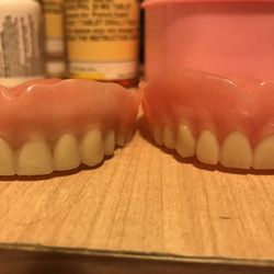 Yarris Family Dental - New are Absolutely wonderful.  I highly recommend Dr Travis Yarris to create your new smile. On on left is old