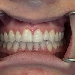 Merrifield Dental Associates