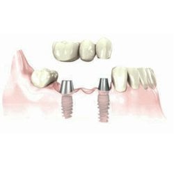NuSmile Dental - Cosmetic Dentistry in Seminole, FL