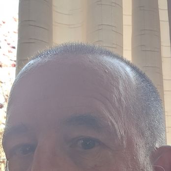 TJ Hair System - 3 weeks - Hair Loss Centers Near Me - Tijuana, BCN TJ Hair System - 3 weeks - Hair Loss Centers Near Me - Tijuana, BCN
