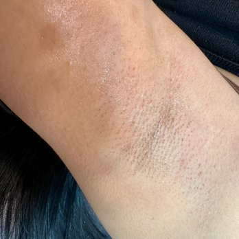The Silk Room - After Picture - Underarm Wax - Waxing Near Me - Reno, Nevada The Silk Room - After Picture - Underarm Wax - Waxing Near Me - Reno, Nevada