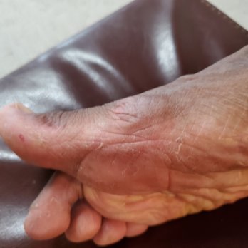 MV Nails and Spa - Side of right foot photo taken next day after pedicure at MV Nails and Spa 8/14/2022 - Nail Salons Near Me - Baltimore, Maryland