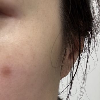 Laser Skin Care Solutions - 5/13 - Skin Care Near Me - Needham, Massachusetts