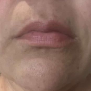 Beauty Babe Club - Before picture - Permanent Makeup Near Me - La Jolla, California Beauty Babe Club - Before picture - Permanent Makeup Near Me - La Jolla, California