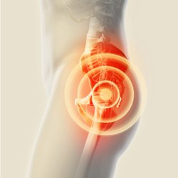 Alex Tauchen MD - ANTERIOR TOTAL HIP ARTHROPLASTY