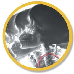 Tocco Chiropractic - Digital Motion X-Ray