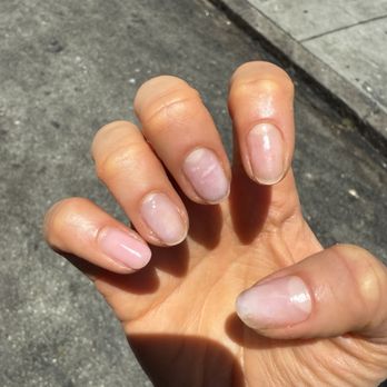 Nail It - Really poorly done gel removal... - Nail Salons Near Me - San Francisco, California Nail It - Really poorly done gel removal... - Nail Salons Near Me - San Francisco, California