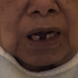 Fairmont Dental - Before