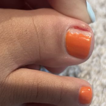 Le Vanity Room - Infection in toe - Eyelash Service Near Me - San Diego , California