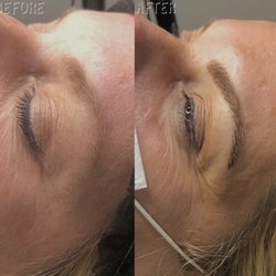 Combination Brows
