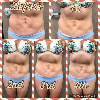 Rose Petal Spa - Body Contouring Near Me - San Antonio, Texas Rose Petal Spa - Body Contouring Near Me - San Antonio, Texas