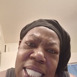 Arden Park Dental Care - Look at these big ass dentures.