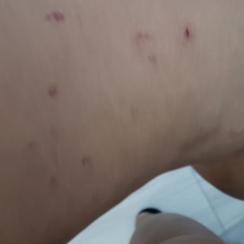 K911! - more bite marks on my other leg - Pet Training Near Me K911! - more bite marks on my other leg - Pet Training Near Me