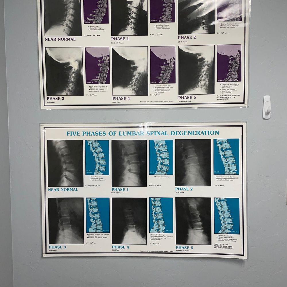 Shipley Chiropractic - Cervical spine - Chiropractors Near Me - Tucson, Arizona