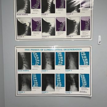 Shipley Chiropractic - Cervical spine - Chiropractors Near Me - Tucson, Arizona