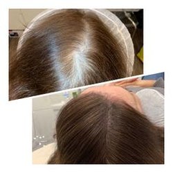 NaturaBella Microblading and Permanent Cosmetics - Scalp Micropigmentation