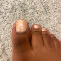Mechanical tool was used to take off gel nail polish. The young man nicked me and did not disclosed he actually injured my nail bed.