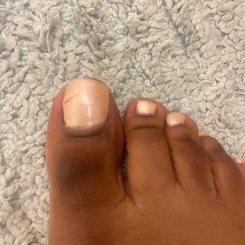 Master Nails - Laurel - Mechanical tool was used to take off gel nail polish. The young man nicked me and did not disclosed he actually injured my nail bed. - Nail Salons Near Me - Laurel, Maryland