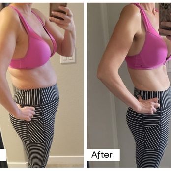BelleSculpt - Body Contouring Near Me - Idaho Falls, Idaho