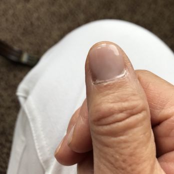 Jonathon Khoi Nail Spa - Peeling thumbs two days after gel mani - Nail Salons Near Me - Maumee, Ohio Jonathon Khoi Nail Spa - Peeling thumbs two days after gel mani - Nail Salons Near Me - Maumee, Ohio