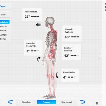 Recondition You - AI-powered 3D posture and movement analysis reveals imbalances affecting the shoulders, helping us build a more precise recovery plan. - Massage Therapy Near Me - Jamaica Plain, Massachusetts Recondition You - AI-powered 3D posture and movement analysis reveals imbalances affecting the shoulders, helping us build a more precise recovery plan. - Massage Therapy Near Me - Jamaica Plain, Massachusetts